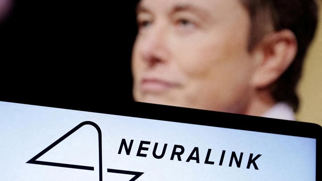 Neuralink Siap Produksi Massal Implan Otak pada 2026