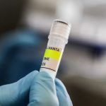Hantavirus Muncul di Jakarta, Ini Kelompok yang Berisiko Tinggi
