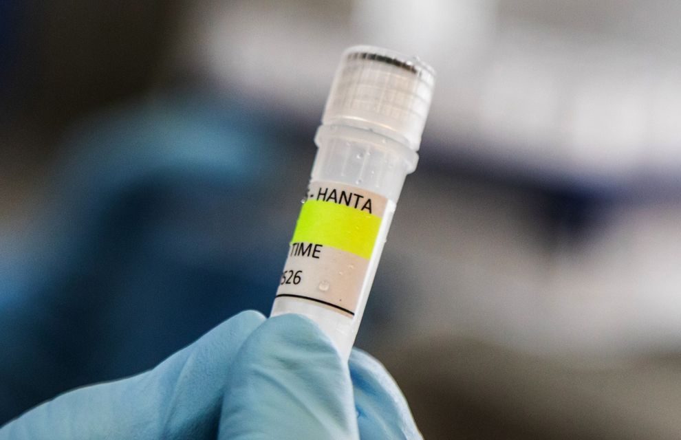 Hantavirus Muncul di Jakarta, Ini Kelompok yang Berisiko Tinggi