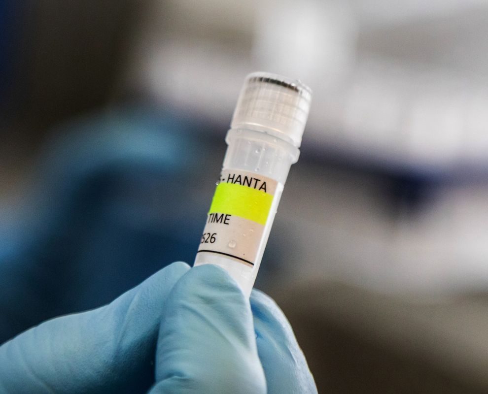 Petugas kesehatan memantau kasus hantavirus di Jakarta
